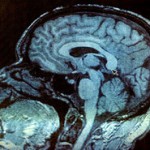 neurology