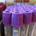 WORRIED ABOUT LOW B12 LAB RESULTS?  WWW.B12PATCH.COM