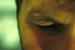 MYOKYMIA IS NOT A HAWAIIAN ISLAND- EYELID TWITCHING AND EYE SPASMS, WWW.B12PATCH.COM