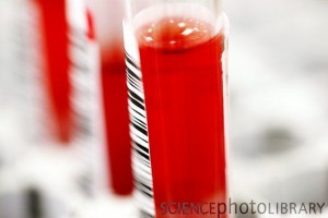 WHY B12 BLOOD TESTS ARE AN EPIC FAIL
